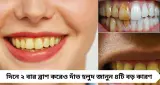Yellow Teeth: দিনে ২ বার ব্রাশ করেও দাঁতে হলুদ দাগ? নেপথ্যে এই ৪ কারণ, জানুন কী বলছেন বিশেষজ্ঞ
