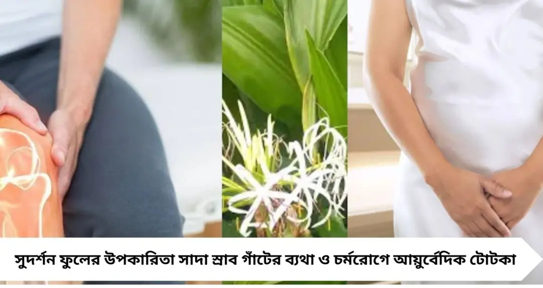 অযত্নে বেড়ে ওঠা ‘সুদর্শন’ ফুলেই লুকিয়ে ওষুধ! সাদা স্রাব, গাঁটের ব্যথা থেকে চর্মরোগ—এক গাছেই বহু উপকার

