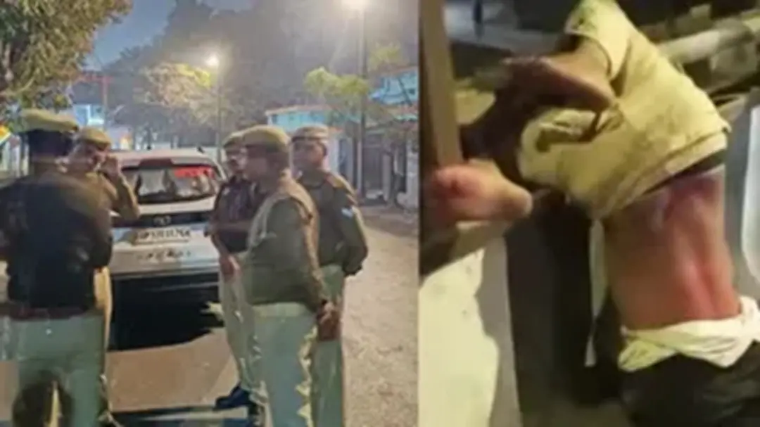 फॉर्च्यूनर की टक्कर से डॉक्टर के भाई की मौत: खुद को भावी ब्लॉक प्रमुख बताने वाला आरोपी, गिरफ्तारी के बाद भी दिखी रंगबाजी