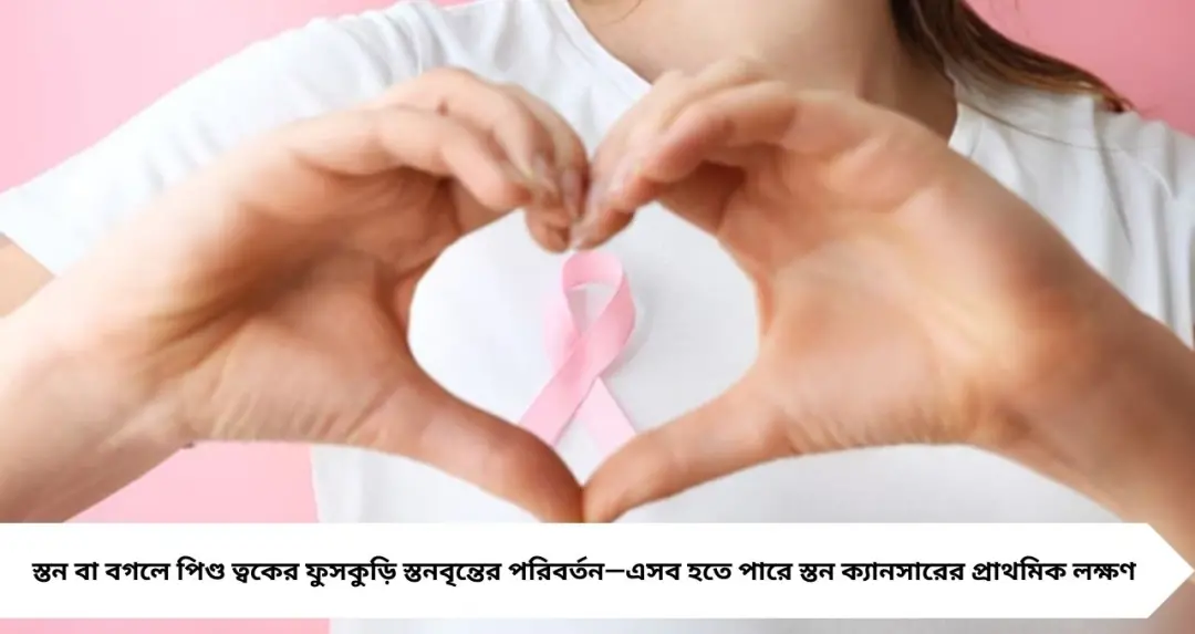 স্তন বা বগলে অচেনা দাগ-ফুসকুড়ি? সতর্ক হোন—এগুলো হতে পারে স্তন ক্যানসারের প্রাথমিক লক্ষণ
