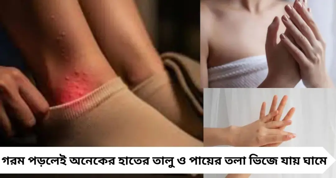 Palms & Feet Sweating: হাত-পায়ে অতিরিক্ত ঘাম? কয়েক ফোঁটা এই উপায়েই মিলতে পারে স্বস্তি, দূর হবে দুর্গন্ধও