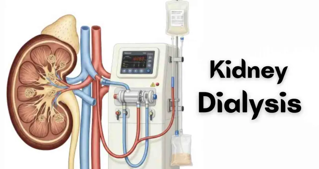डायलिसिस शुरू हो जाए तो क्या हमेशा करना होगा? जानें डॉक्टर की राय