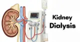 डायलिसिस शुरू हो जाए तो क्या हमेशा करना होगा? जानें डॉक्टर की राय