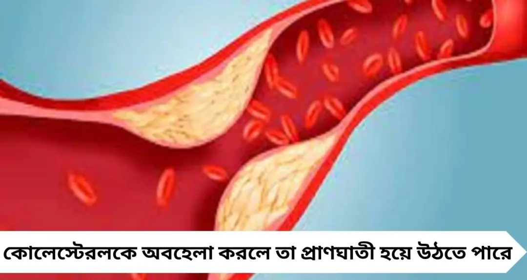 Cholesterol Alert 2026: নীরব ঘাতকের ফাঁদ! আগে থেকে নিয়ন্ত্রণ না করলে হৃদরোগের ঝুঁকি দ্বিগুণ—সতর্ক করল আমেরিকার নির্দেশিকা
