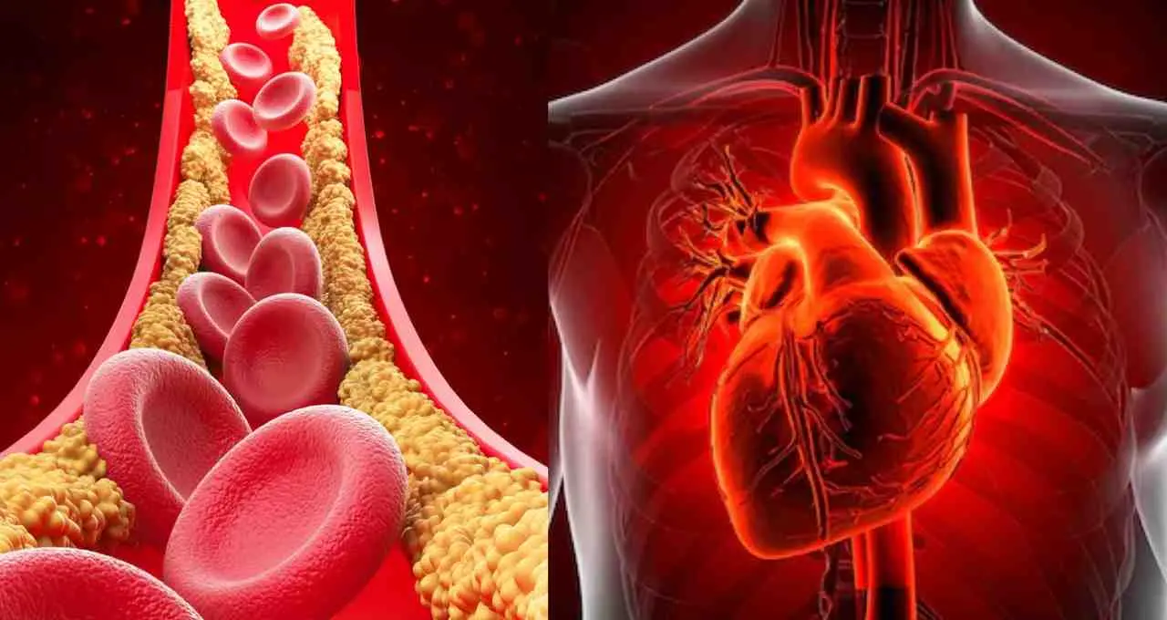 LDL कोलेस्ट्रॉल नियंत्रण पर नई गाइडलाइन, जानें सुरक्षित सीमा और स्वास्थ्य टिप्स