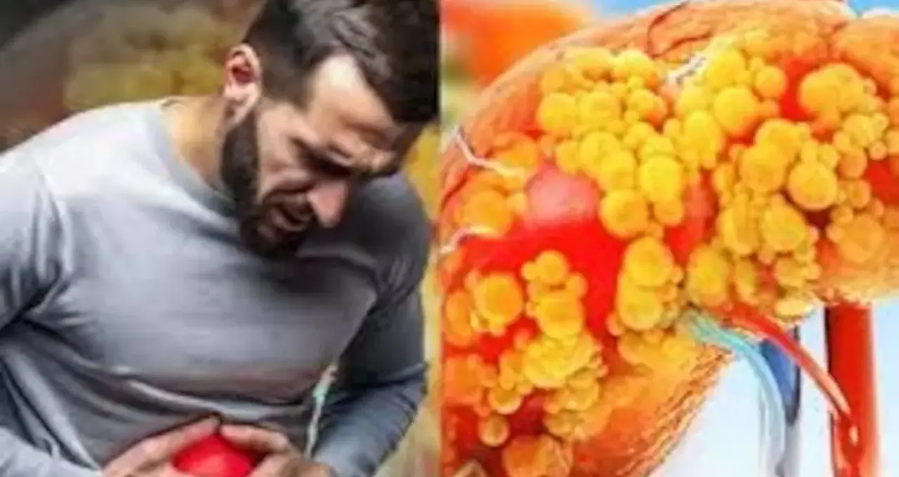 লিভার সিরোসিসের ঝুঁকি বাড়াচ্ছে এই ৭ খাবার! এখনই সতর্ক না হলে বিপদ