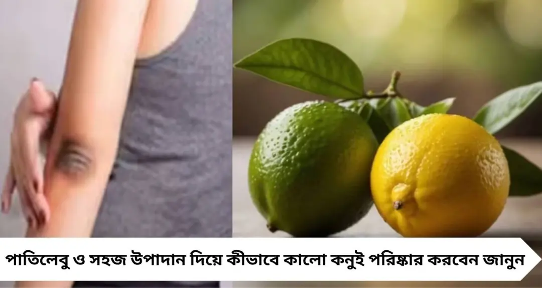 কালো কনুই নিয়ে চিন্তা শেষ! পাতিলেবুর সঙ্গে ‘এটা’ মিশিয়ে মাখলেই মিলবে ঝকঝকে ত্বক
