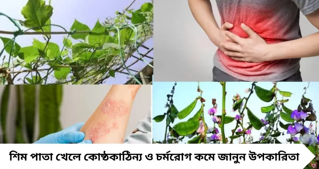 কোষ্ঠকাঠিন্য থেকে চর্মরোগ—সবই সারায় ‘শিম পাতা’! সস্তা এই লতানো গাছেই লুকিয়ে ওষুধের ভান্ডার
