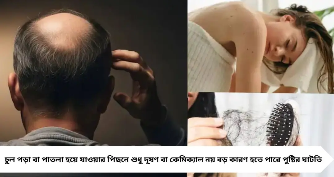 Vitamins & Hair Fall: কোন পুষ্টির অভাবে চুল ঝরে টাক? শুধু শ্যাম্পু নয়, সমস্যা লুকিয়ে শরীরেই!
