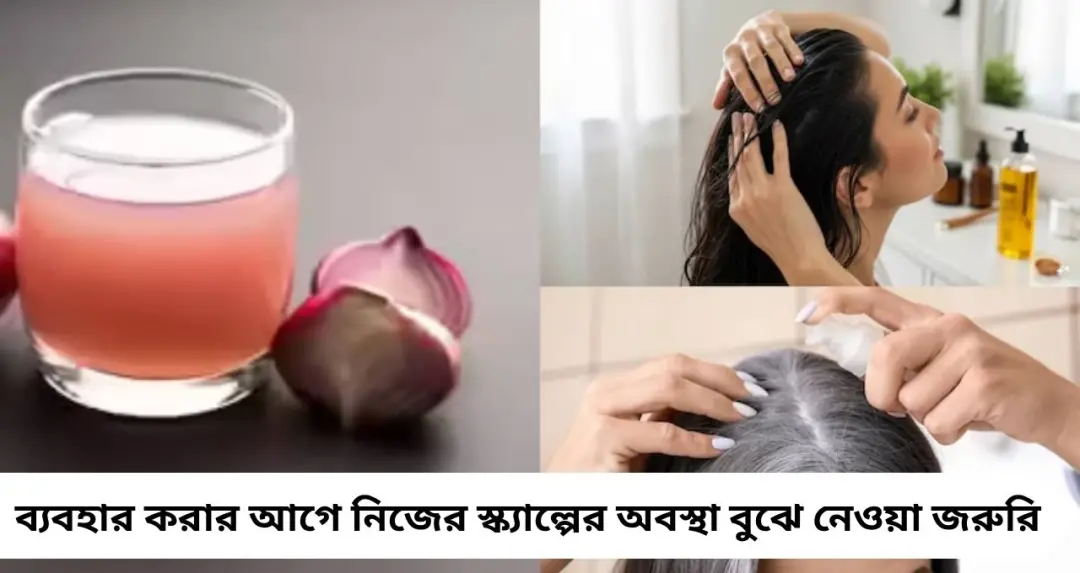 পেঁয়াজের রসে কি সত্যিই থামে চুল পড়া? জেনে নিন সত্যি, না মিথ—কারা এড়িয়ে চলবেন অবশ্যই
