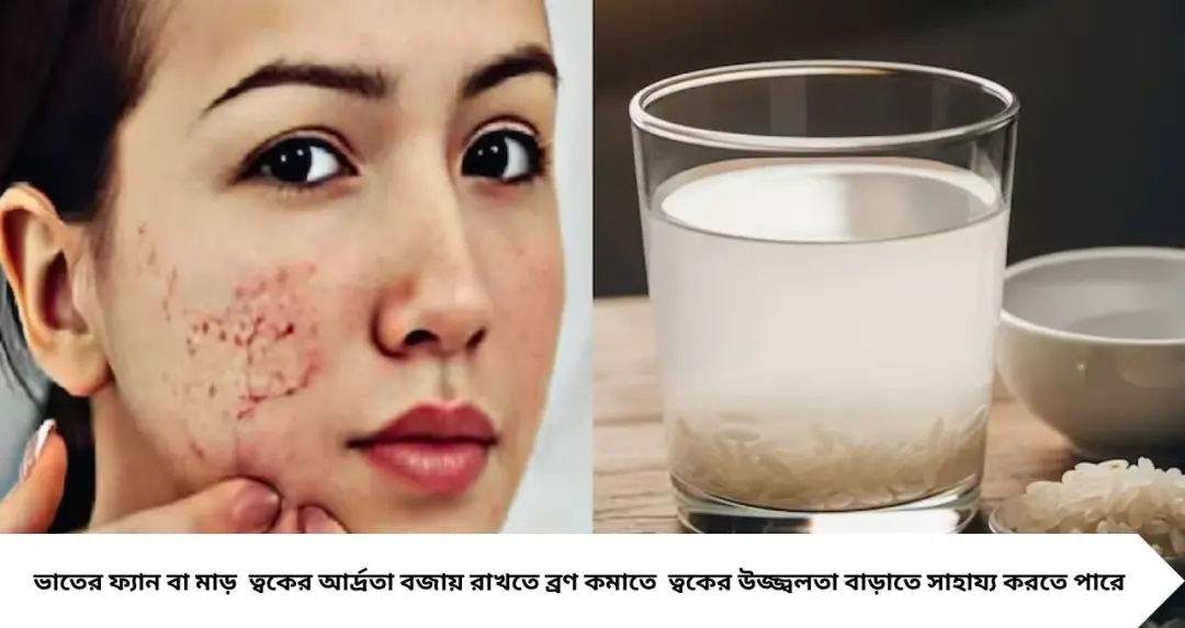 ভাতের ফ্যানেই’ ত্বকের ম্যাজিক! ব্রণ-ফুসকুড়ি দূরে রেখে বাড়বে জেল্লা, বয়সও আটকে যাবে অনেকটাই
