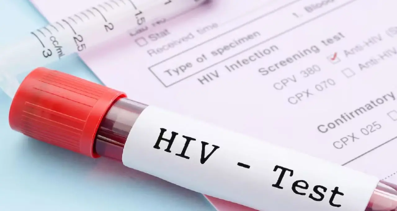 HIV চিকিৎসায় নতুন দিগন্ত! রোগপ্রতিরোধী কোষকেই ‘জীবন্ত অস্ত্র’ বানিয়ে সংক্রমণ দমনের আশার আলো দেখাল CAR-T থেরাপি
