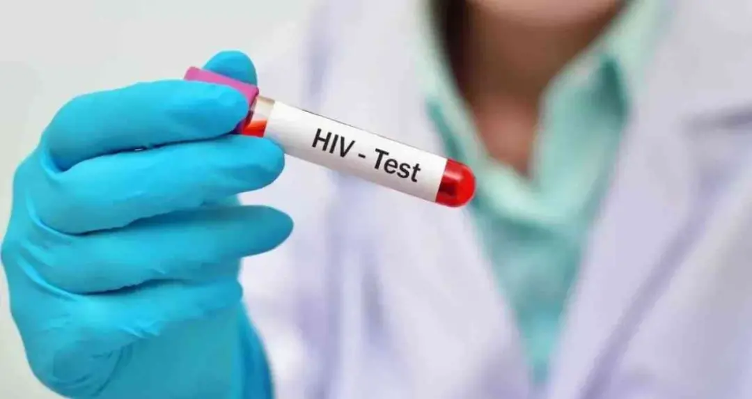 जांजगीर जिला जेल में 4 कैदी HIV पॉजिटिव मिले, स्वास्थ्य विभाग ने शुरू की जांच