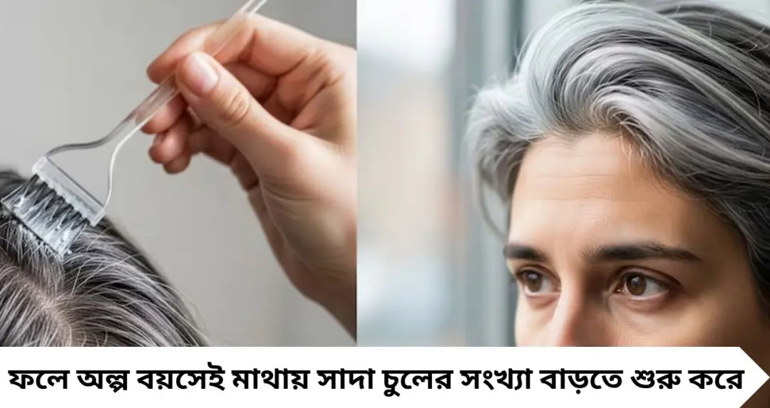 ২০ বছরেই মাথায় সাদা চুল? ভিটামিনের ঘাটতিই কি আসল কারণ! জানুন কোন পুষ্টির অভাবে দ্রুত পেকে যায় চুল
