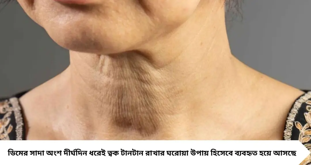 অকালেই গলার চামড়া ঝুলে যাচ্ছে? ‘টার্কি নেক’ দূর করতে ভরসা রাখুন এই ৫ ঘরোয়া উপায়ে, ফিরবে টানটান সৌন্দর্য
