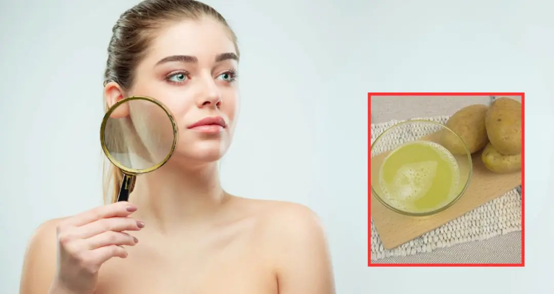चेहरे के काले धब्बे और झाइयों के लिए आलू का घरेलू नुस्खा: क्या वास्तव में फायदेमंद है यह प्राकृतिक उपाय?