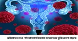 ঋতুস্রাবে অস্বাভাবিক রক্তপাত? মেনোপজের পর এই লক্ষণ দেখলেই সতর্ক হোন, গাইনোকোলজিক্যাল ক্যানসারের ১০ গুরুত্বপূর্ণ উপসর্গ জানুন