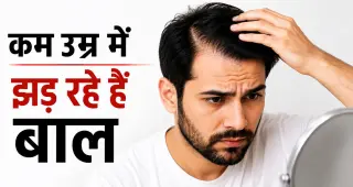 कम उम्र में झड़ने लगे हैं बाल? पुरुषों में गंजेपन के 5 शुरुआती संकेत, समय रहते पहचानना क्यों है जरूरी