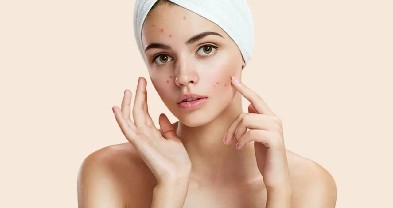 Skincare Tips: चेहरे के काले धब्बे और पिंपल्स से हैं परेशान? जानिए डॉक्टर द्वारा बताए गए असरदार उपाय