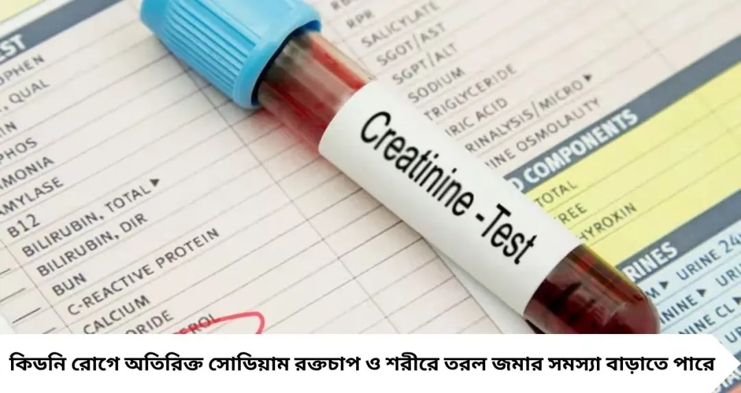 রক্তে ক্রিয়েটিনিন বাড়লেই কি কিডনি নষ্ট? কোন খাবার কমাবেন, কী খাবেন জেনে নিন
