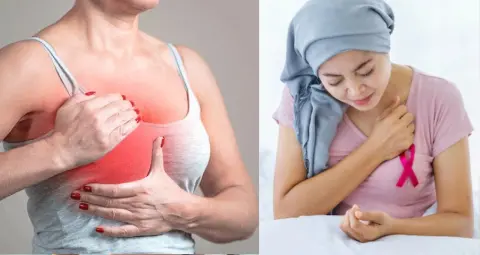 वर्ल्ड ब्रेस्ट कैंसर रिसर्च डे: शोध, जागरूकता और समय पर इलाज की अहमियत