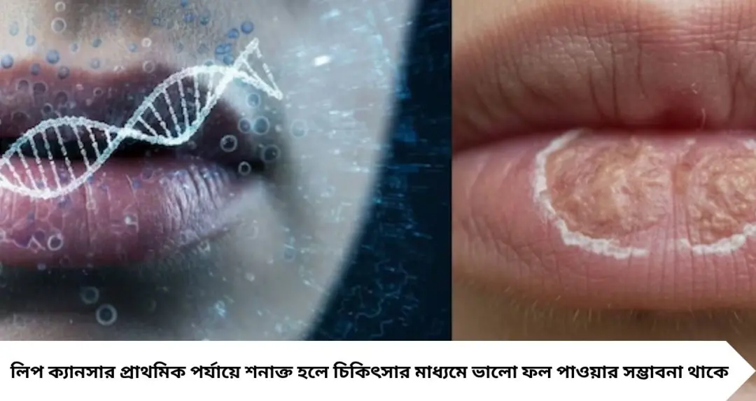 Lip Cancer Symptoms: ঠোঁটে এই দাগ বা ক্ষতকে অবহেলা নয়! রক্তপাত, অসাড়তা থেকে পুরু হয়ে যাওয়া—জেনে নিন লিপ ক্যানসারের সতর্কবার্তা