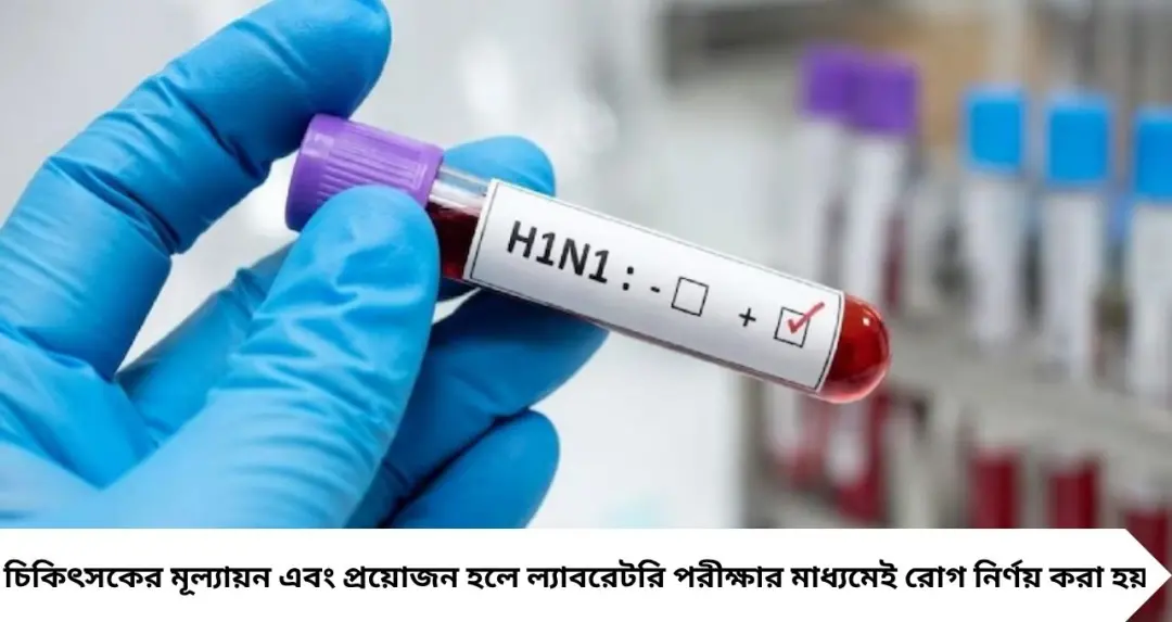 সোয়াইন ফ্লু আতঙ্ক: সাধারণ সর্দি-কাশি নাকি H1N1? কোন লক্ষণে সতর্ক হবেন, জানুন চিকিৎসকদের পরামর্শ
