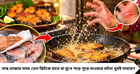 মাছ ভাজতে গিয়ে গরম তেলের ছিটে হাতে ফোসকা? কড়াইয়ে দেওয়ার আগে এই কাজগুলি করলে কমবে তেল ছিটকে পড়ার ঝুঁকি
