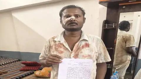 Sanhaula Hatiya Assault Case: 15 to 20 Unidentified People Accused Over Collection Dispute