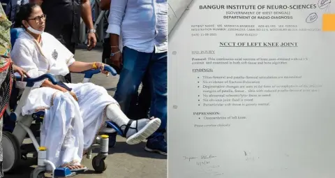 ममता बनर्जी की 2021 की पैर की चोट पर फिर विवाद, मेडिकल रिकॉर्ड सार्वजनिक होने पर अस्पताल को कानूनी नोटिस