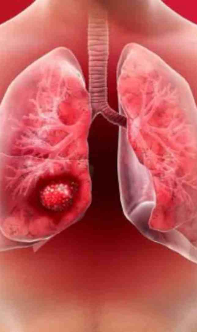 कैंसर से जुड़े 9 बड़े भ्रम, जिन पर आज भी लोग कर लेते हैं भरोसा